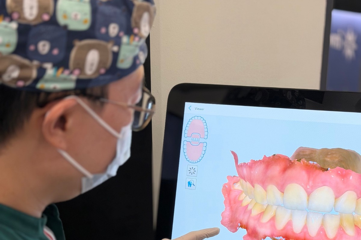 A dentist at Calm Dental reviewing a patient’s 3D intraoral scan on the iTero screen
